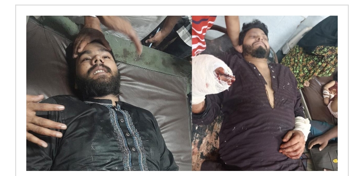 সিলেটে দুই ছাত্রলীগ নেতার হাত পায়ের রগ কর্তন