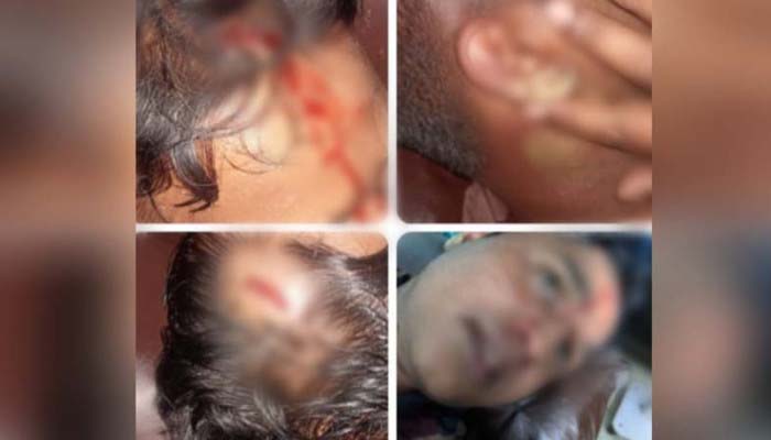জৈন্তাপুরে চোরাকারবারিদের হামলায় ২ বিজিবি সদস্য আহত