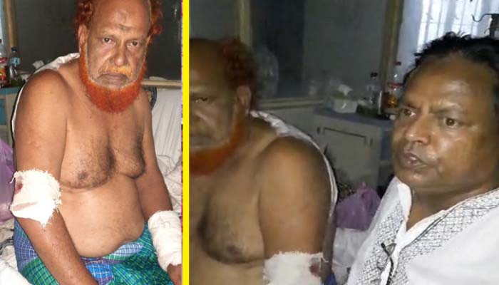 কৃষকদল নেতা গণি মিয়ার শয্যাপাশে বিএনপি নেতা খসরু