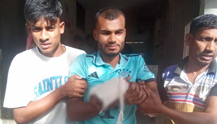 বোমা বিস্ফোরণে কবজি বিচ্ছিন্ন কলেজছাত্রের