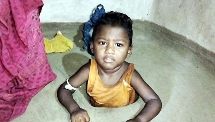 ঘরের গর্তে ঢুকিয়ে খাবার দেওয়া হয় প্রতিবন্ধী শিশু গোপালকে