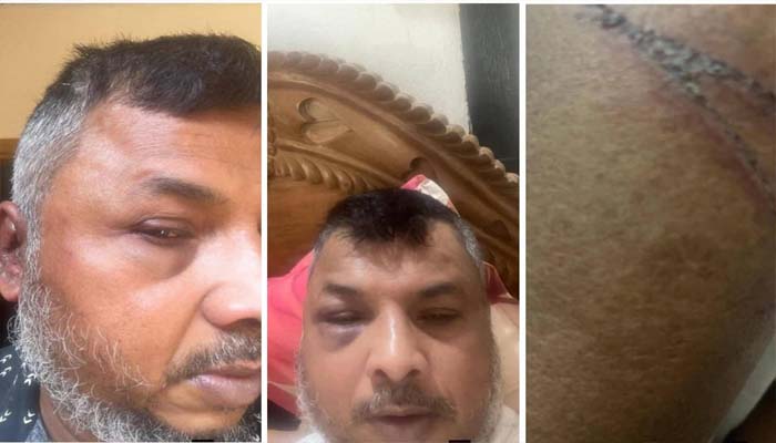 সিলেটে সাবেক উপজেলা চেয়ারম্যান ওপর দুর্বৃত্তদের হামলা