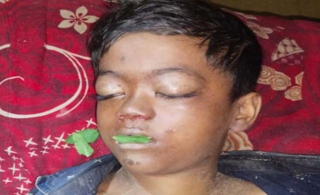 জৈন্তাপুরে বালুবোঝাই পিকআপের পেছনে ঝুলে ছিল শিশু, মুহূর্তেই মর্মান্তিক মৃত্যু