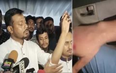 জৈন্তাপুরে হামলায় আহত হলেও মামলা করবেন না নাসীরুদ্দীন পাটোয়ারী