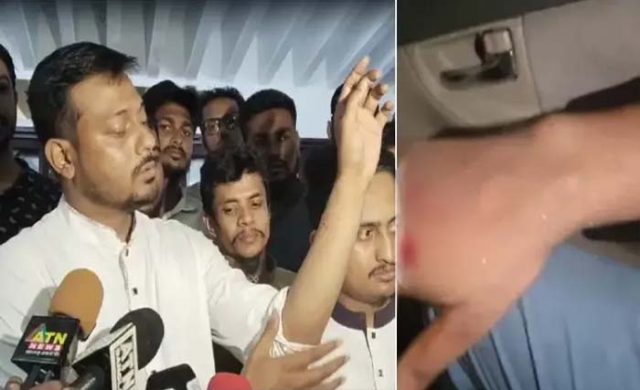জৈন্তাপুরে হামলায় আহত হলেও মামলা করবেন না নাসীরুদ্দীন পাটোয়ারী