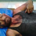 মসজিদের বালু নেওয়া নিয়ে বিরোধ, বিয়ানীবাজারে দুই দিনমজুরের ওপর সশস্ত্র হামলার অভিযোগ