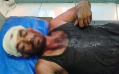 মসজিদের বালু নেওয়া নিয়ে বিরোধ, বিয়ানীবাজারে দুই দিনমজুরের ওপর সশস্ত্র হামলার অভিযোগ
