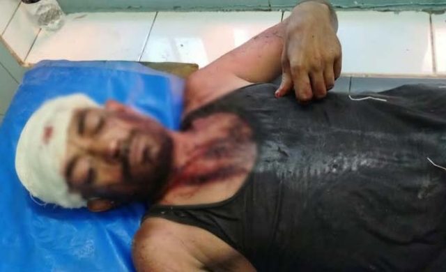 মসজিদের বালু নেওয়া নিয়ে বিরোধ, বিয়ানীবাজারে দুই দিনমজুরের ওপর সশস্ত্র হামলার অভিযোগ
