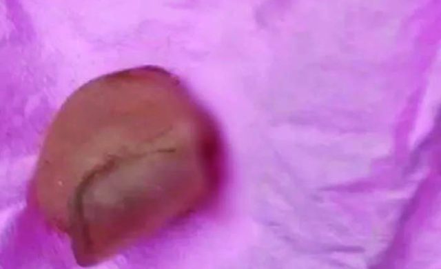 চোরের আঙুল কামড়ে অর্ধেক রেখে দিলেন গৃহবধূ