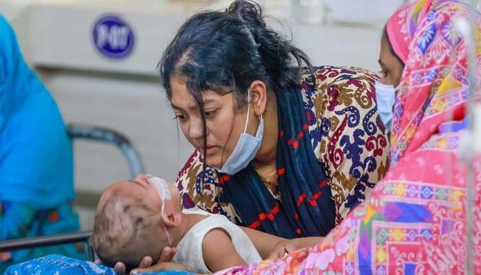 সিলেটে হাম পরিস্থিতির অবনতি, ২৪ ঘণ্টায় শনাক্ত ২৪