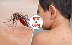 সিলেটে হামে শিশুর মৃত্যু, ডেঙ্গুতে নতুন আক্রান্ত ৮