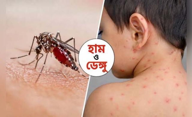 সিলেটে হামে শিশুর মৃত্যু, ডেঙ্গুতে নতুন আক্রান্ত ৮