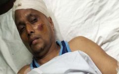 জৈন্তাপুরে ডিআই পিকআপের ধাক্কায় বিজিবি সদস্য আহত